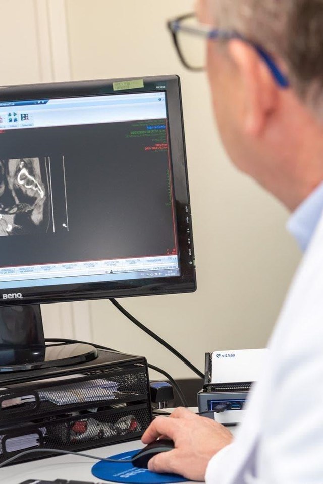 4 consejos para evitar nuevos abscesos anales