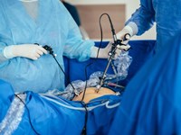 Beneficios de la cirugía laparoscópica en el tratamiento del aparato digestivo