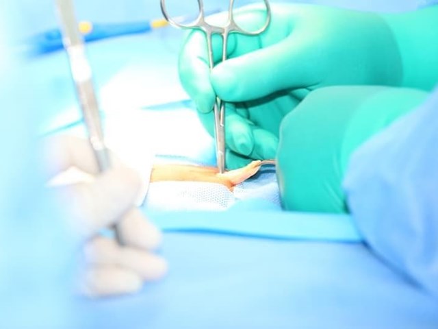 Cirugía de hernia inguinal: riesgos, tipo de anestesia y tiempo de hospitalización