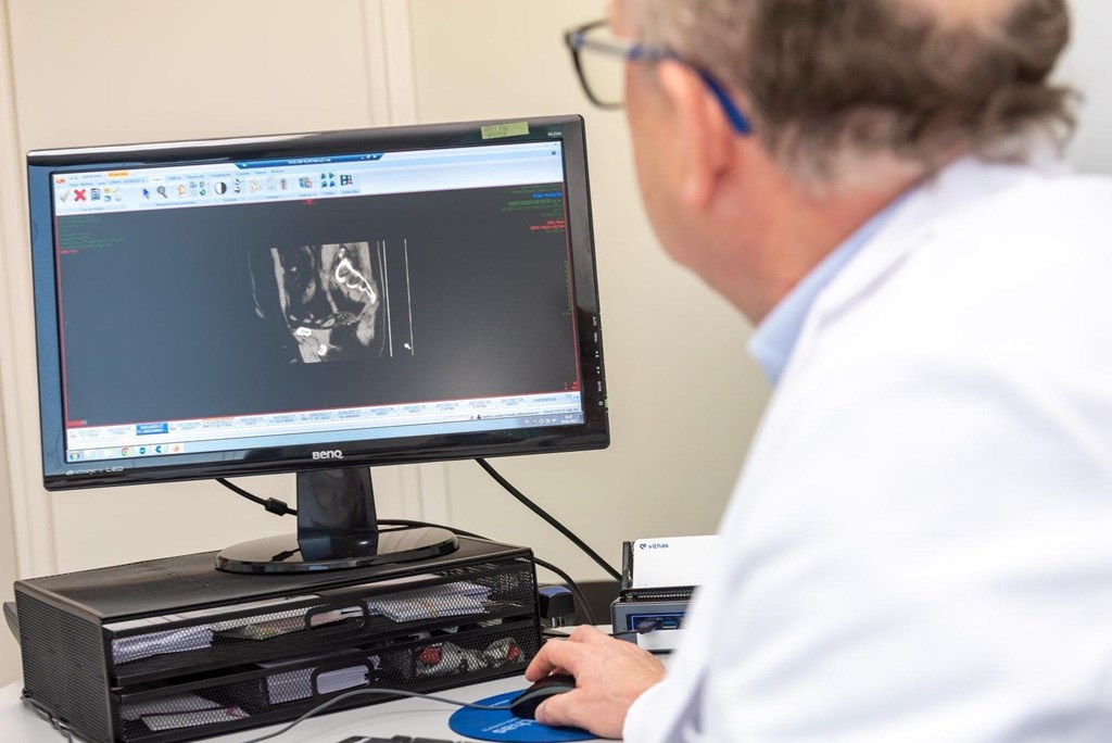 ¿Pueden desaparecer las hemorroides sin cirugía?