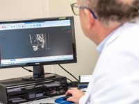 ¿Pueden desaparecer las hemorroides sin cirugía?