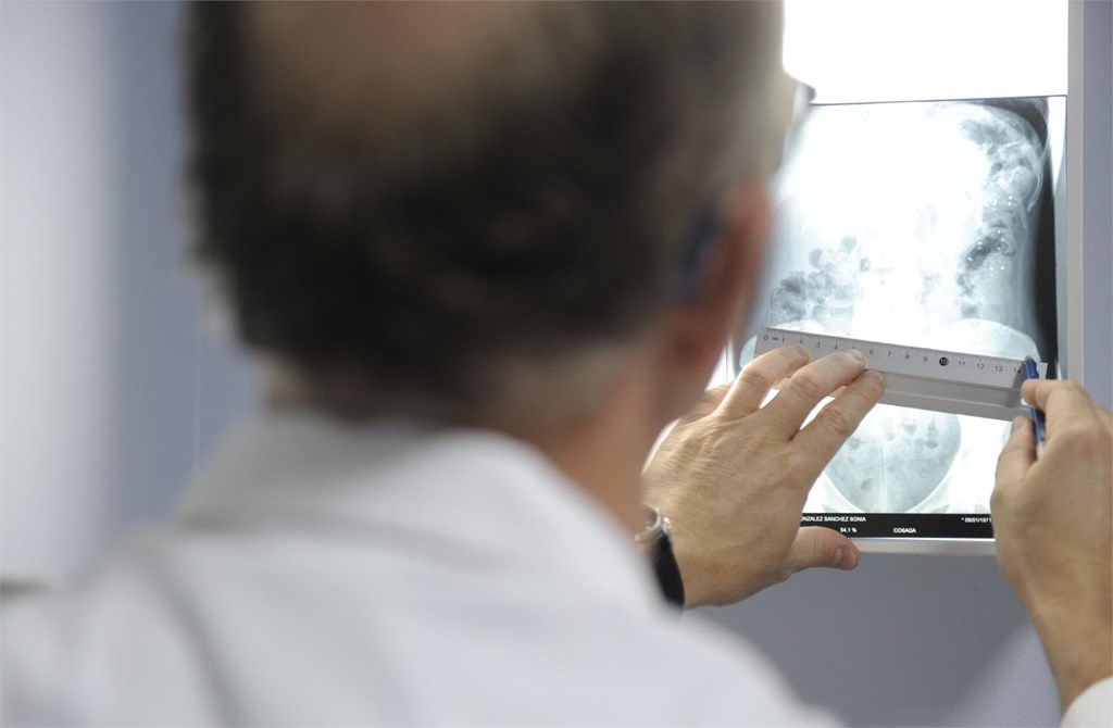 Si necesito una ostomía por cáncer de recto, ¿será temporal o permanente?