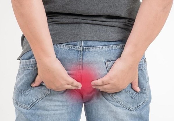 Síntomas de las hemorroides, ¿Cómo puedo saber que las padezco?