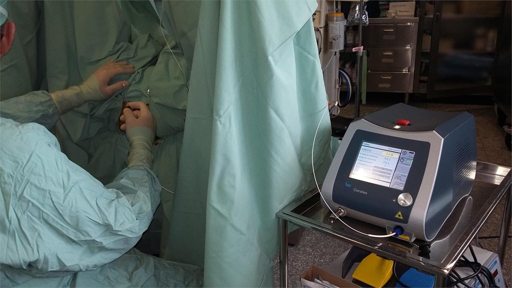 Ventajas de la cirugía laparoscópica para el paciente
